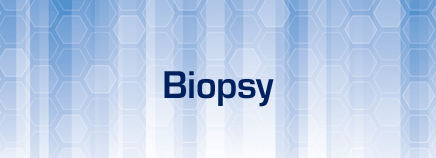 Kidney Biopsy, biopsia nefrou